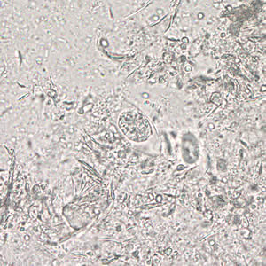 C_belli_oocyst_wtmt2_40x.jpg