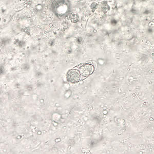 C_belli_oocyst_wtmt_40x.jpg