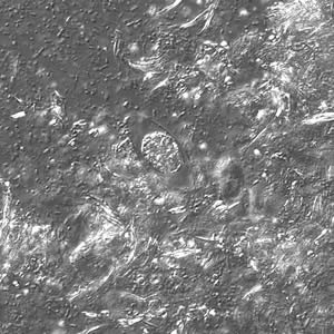 C_belli_oocyst_wtmt_DIC2_40x.jpg