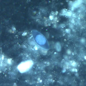 C_belli_oocyst_wtmt_uv2_40x.jpg