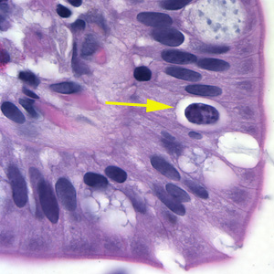 Cystoisospora_HE_1.jpg