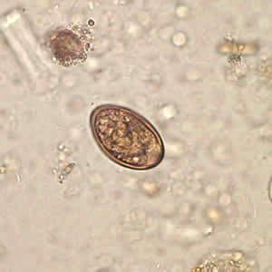 D_dendriticum_egg_wtmt_JCG_B.jpg