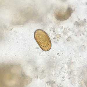 Dicrocoelium_HB2.jpg