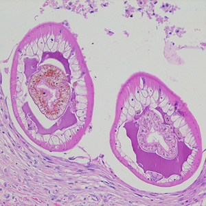 Dioctophyme_LTU_A.jpg