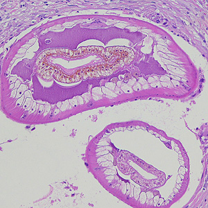 Dioctophyme_LTU_B.jpg