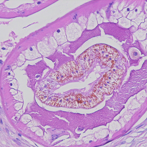 Dioctophyme_LTU_D.jpg Figure D