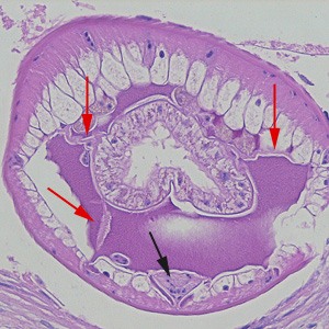 Dioctophyme_LTU_E.jpg
