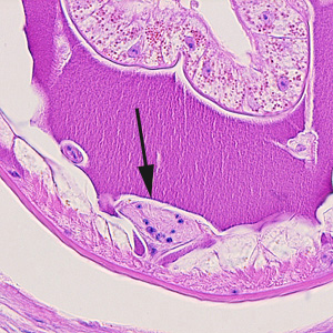 Dioctophyme_LTU_F.jpg