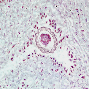 D_renale_egg_tissue1.jpg