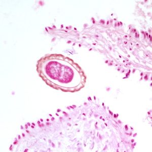D_renale_egg_tissue3.jpg