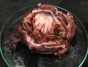 D_re_kidney Figure C
