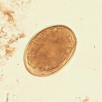Diph_egg_1 Figure G: