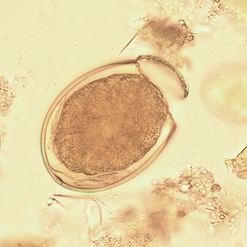 Diph_egg_2 Figure H: