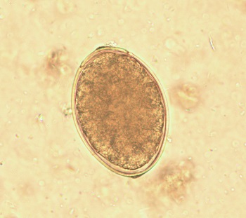 Diph_egg_3 Figure I