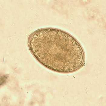 Diph_egg_4 Figure J