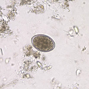 Dlatum_egg_wtmt2.jpg Figure E