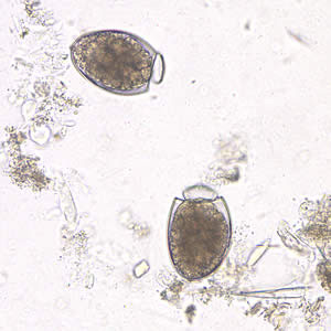 Dlatum_egg_wtmt3.jpg Figure F
