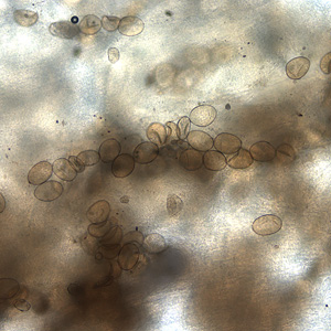 Dlatum_eggs_FL.jpg Figure C