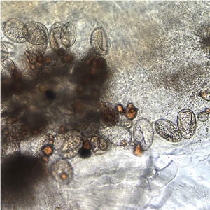 Dlatum_eggs_inworm.jpg Figure D