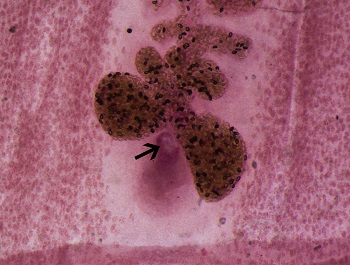 Diph_GP Figure F