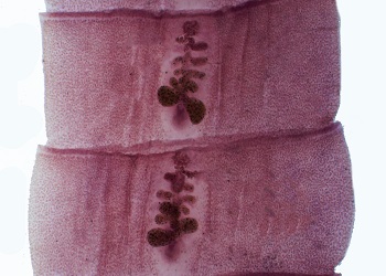 Diph_proglottids Figure E