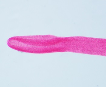 Diph_scolex Figure G