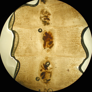Dlatum_proglottid_FL.jpg Figure B