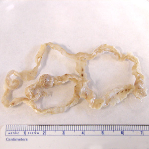 Dlatum_whole_worm_FL.jpg Figure A