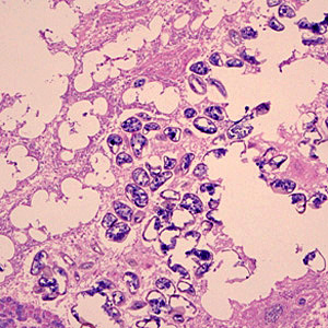 Diphyllobothrium_tissue_WA_100x2.jpg Figure B