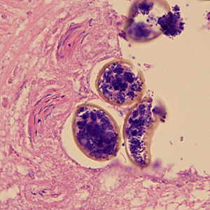Diphyllobothrium_tissue_WA_500x1.jpg Figure C