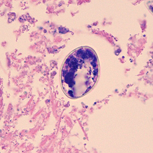 Diphyllobothrium_tissue_WA_500x2.jpg Figure D