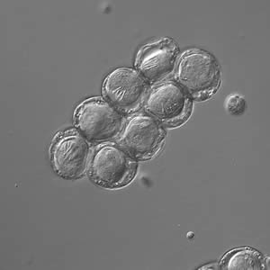 Dcaninum_eggpk_DIC.jpg