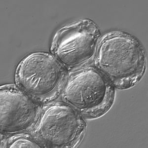 Dcaninum_eggpk_DIC_crop.jpg