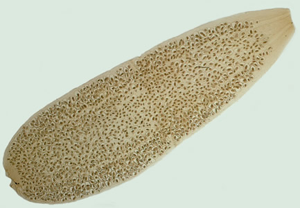 Dcaninum_proglottid2.jpg