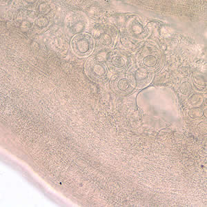 Dcaninum_proglottid3.jpg
