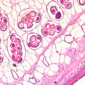 Dcaninum_proglottid_he2.jpg