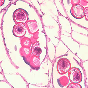 Dcaninum_proglottid_he3.jpg