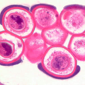 Dcaninum_proglottid_he4.jpg