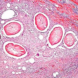 Dirofilaria_DerksB.jpg