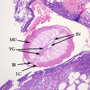 Dirofilaria_PA2_answer.jpg