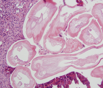 Dirofilaria_Univ_MI.jpg