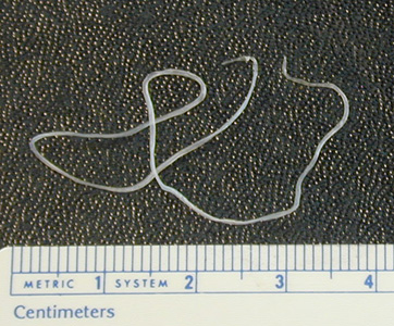Dirofilaria_eye_BAM1.jpg