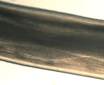Dirofilaria_eye_BAM4.jpg