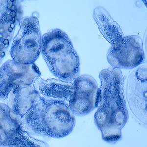 Echinococcus_hydatidsand_A.jpg Figure C