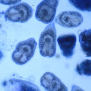 Echinococcus_hydatidsand_B.jpg Figure D