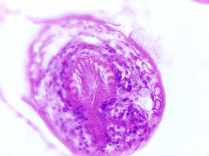 Eg_cyst5 Figure B