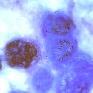 EchinococcusCellNetix_A.jpg Figure A