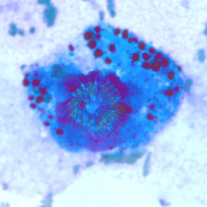 EchinococcusCellNetix_B.jpg Figure B