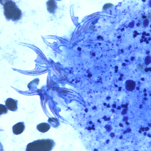 EchinococcusCellNetix_D.jpg