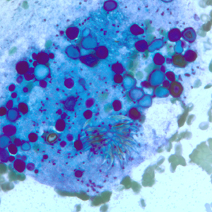 EchinococcusCellNetix_E.jpg